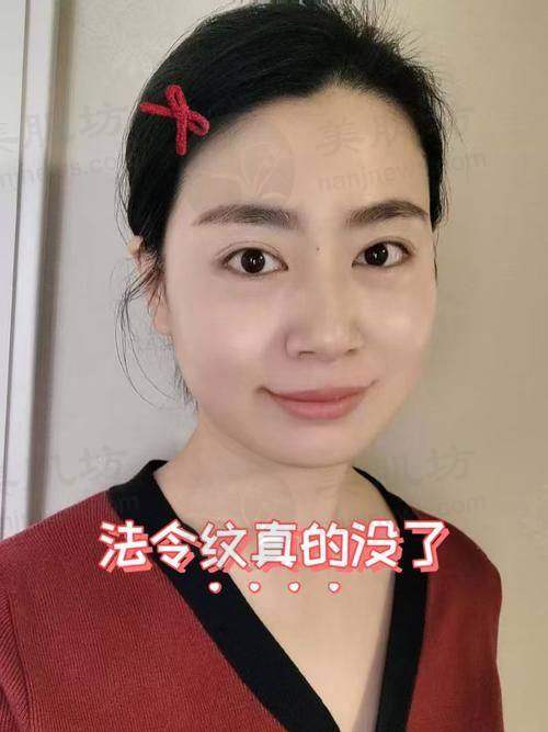 设备环境介绍