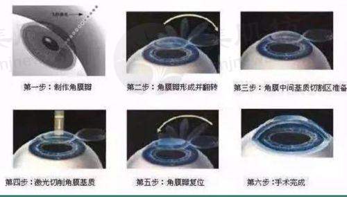 优惠活动详情
