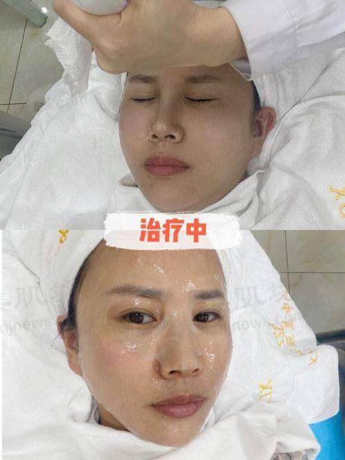 优惠活动详情