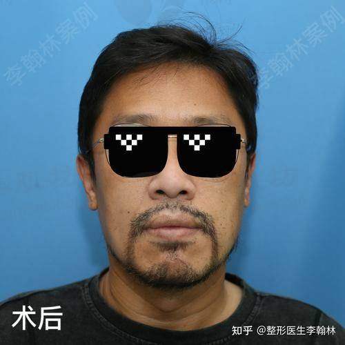 患者真实评价