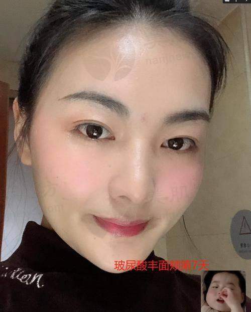 擅长项目详解