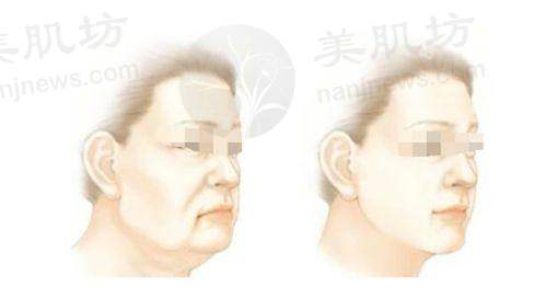 临床实例分享
