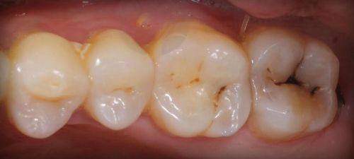 结尾预约号召