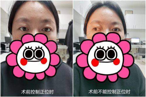 患者真实评价
