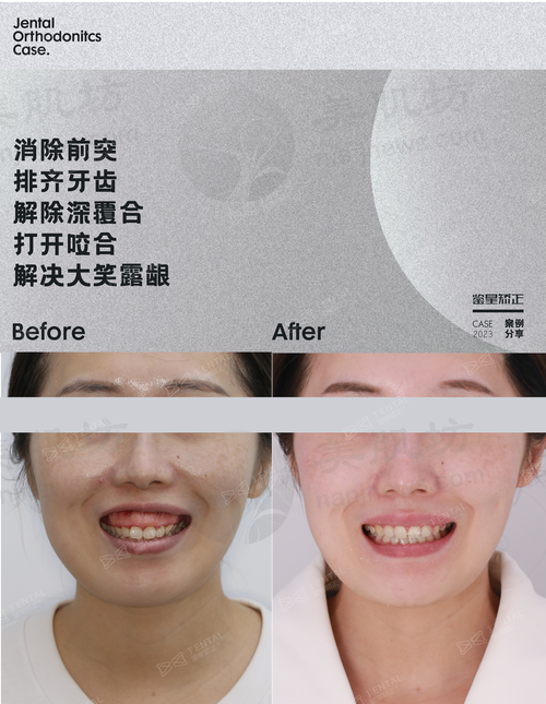 擅长项目详解