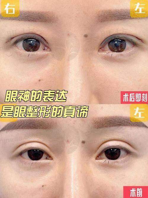 优惠活动详情