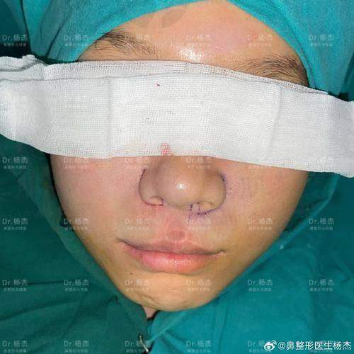 优惠活动详情
