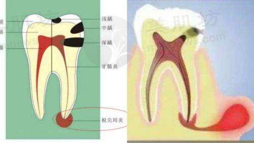临床实例分享