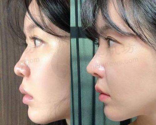 预约优惠活动