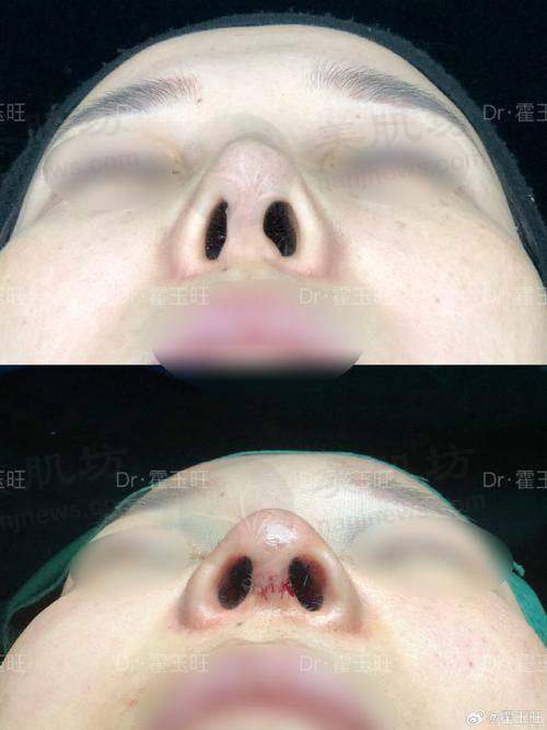 擅长项目详解