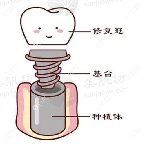 预约优惠活动