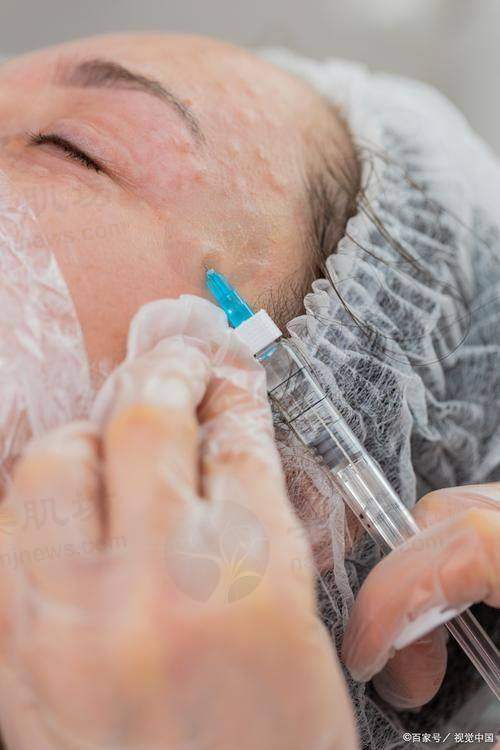 临床实例分享