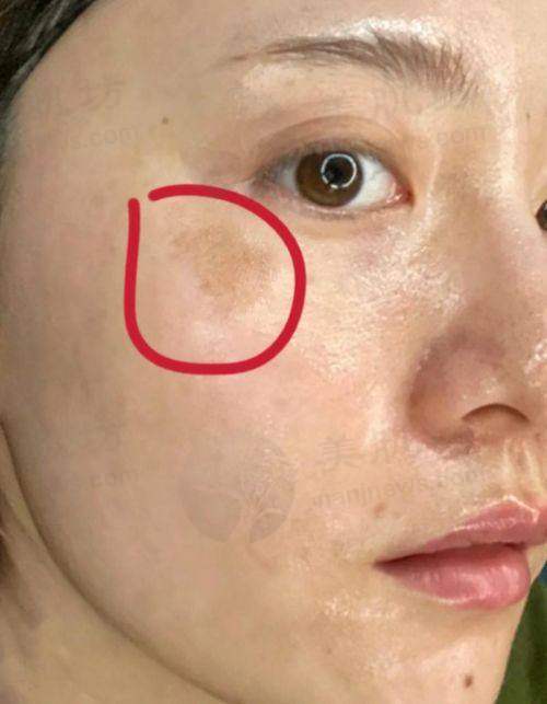擅长项目详解