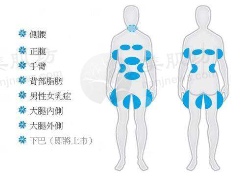 优惠活动详情