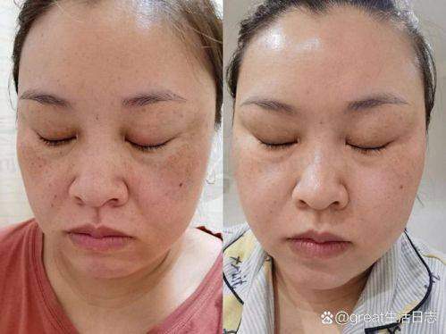 预约优惠活动