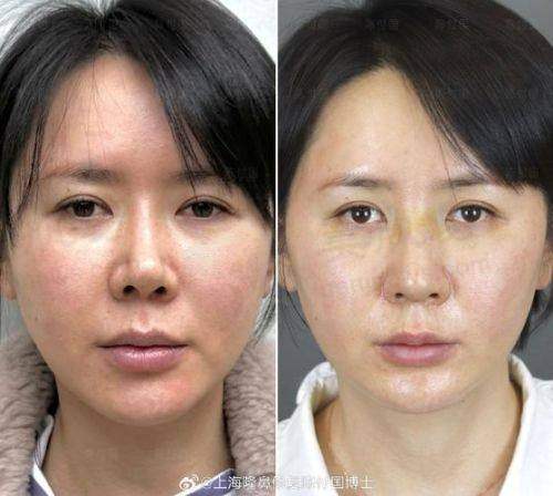 优惠活动详情
