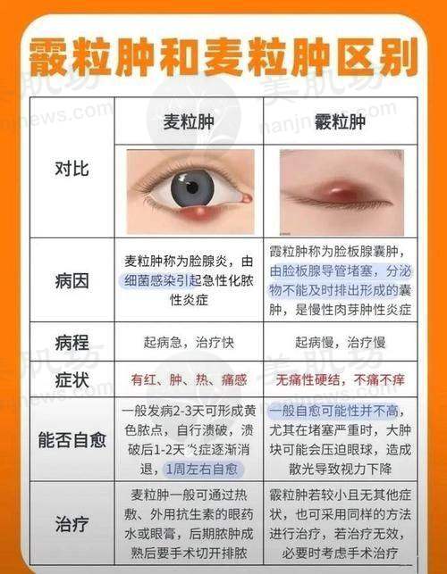 擅长项目详解