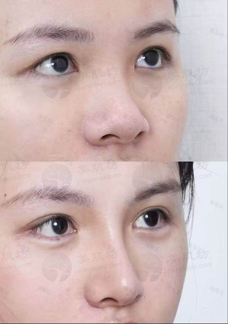临床实例分享