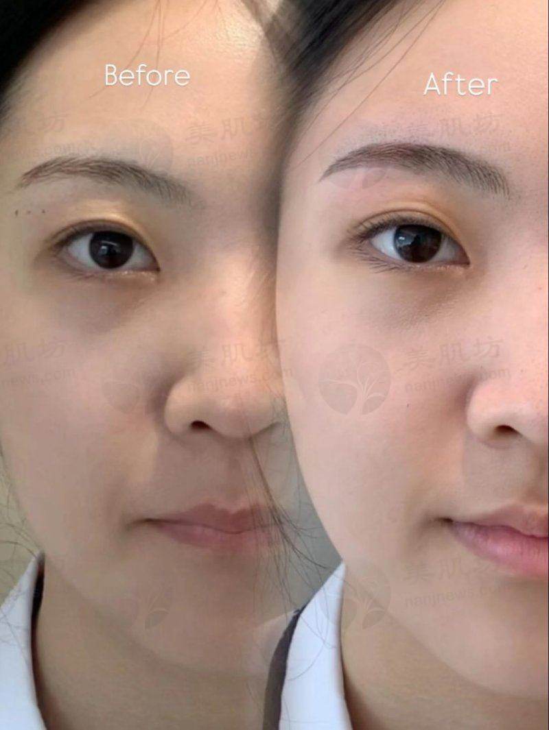 预约优惠活动